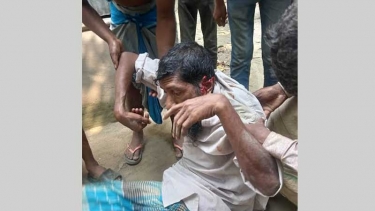 জামালপুরে ভিক্ষা চাওয়ায় ভিক্ষুককে পিটিয়ে আহত