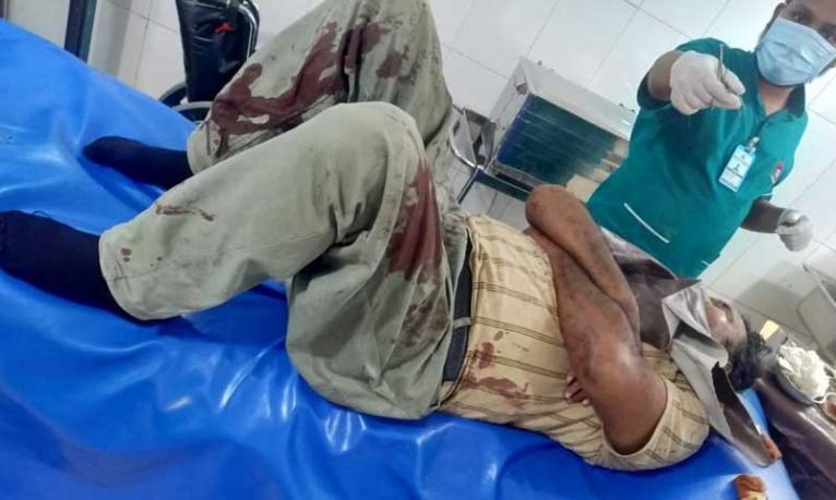 ঢাকা-নারায়ণগঞ্জ লিংক রোডে ট্রাক-সিএনজির সংঘর্ষে চালকসহ আহত ৫