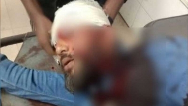 এবার এনসিপির খুলনা বিভাগীয় প্রধানের মাথায় গুলি