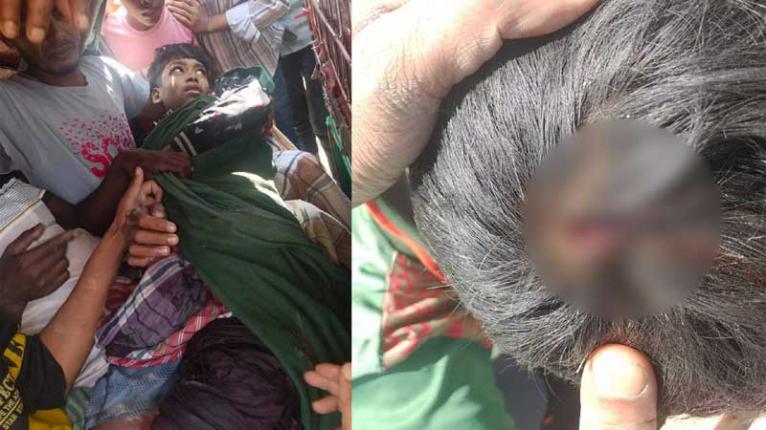 টেকনাফ সীমান্তের ওপার থেকে আসা গুলিতে বাংলাদেশি ২ কিশোর আহত