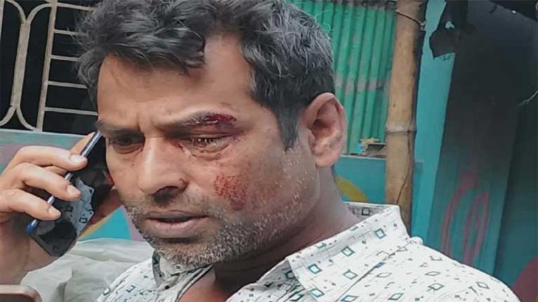 জামালপুরে সেহরি খেয়ে ফেরার পথে যুবককে পিটিয়ে জখম