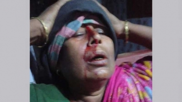 সালথায় সম্পত্তি নিয়ে মাকে পিটিয়ে রক্তাক্ত করল সন্তানরা