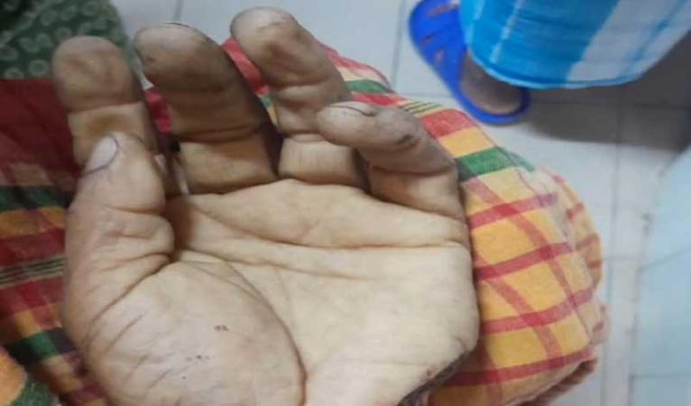 নগরকান্দায় বড় ভাইয়ের হাতের কবজি কেটে নেওয়ার অভিযোগ ছোট ভাইয়ের বিরুদ্ধে