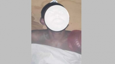 ফরিদপুর মেডিকেল কলেজ হাসপাতালে অজ্ঞাতনামা রোগীর মৃত্যু