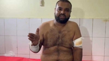 মধুখালীতে ওষুধ কোম্পানির বিক্রয় প্রতিনিধিকে কুপিয়ে জখম