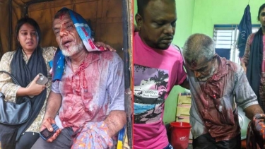 ফতুল্লায় মামলা প্রত্যাহার না করায় বাদীকে কুপিয়ে জখম