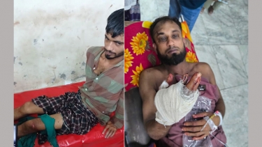 মাদক সেবনে বাধা দেওয়ায় কালকিনিতে ৩ জনকে কুপিয়ে জখম, আশঙ্কাজনক অবস্থায় ঢাকায় ভর্তি