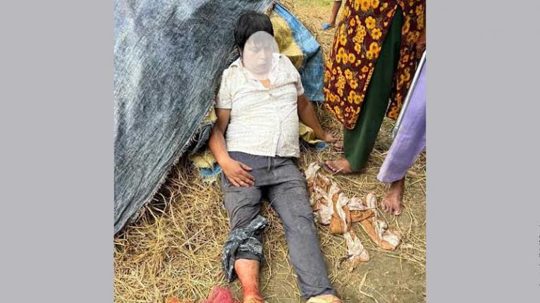 ফরিদপুরে বাড়িতে ঢুকে স্কুলশিক্ষককে গুলি করার অভিযোগ