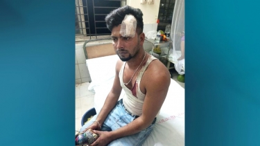 সরিষাবাড়ীতে মাদকবিরোধী সভা ডাকায় যুবককে কুপিয়ে আহত